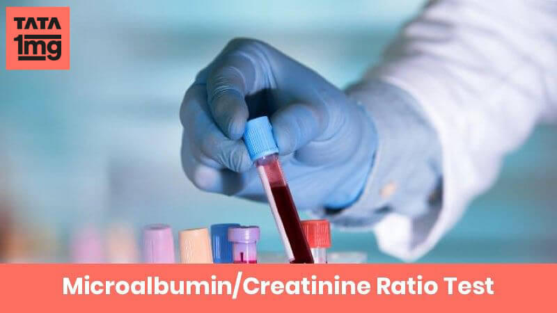 Microalbumin/Creatinine Ratio